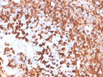 Recombinant CD79a Antibody