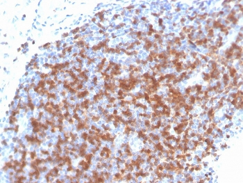 Recombinant ZAP70 Antibody