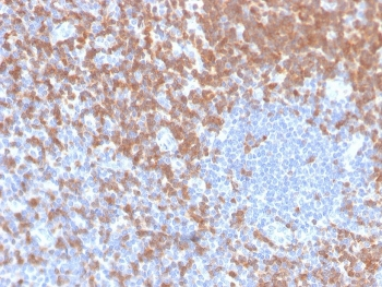 Recombinant ZAP70 Antibody