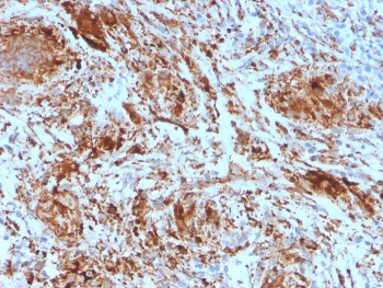 TIM-3 Antibody / HAVCR2