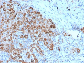 TIM-3 Antibody / HAVCR2