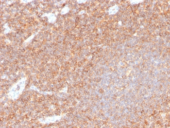 Recombinant CD44 Antibody