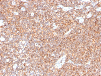 Recombinant CD44 Antibody
