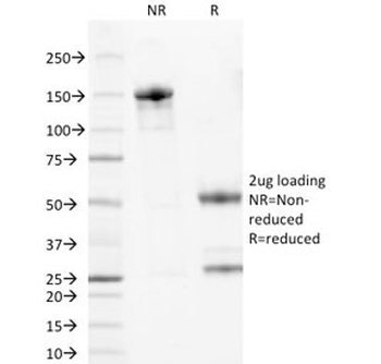 Bcl-2 Antibody