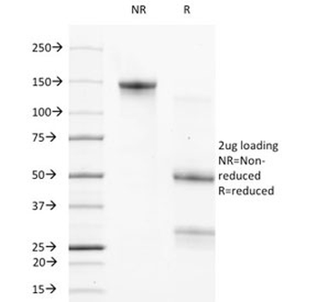 Bcl-2 Antibody