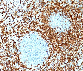 Bcl2 Antibody Cocktail