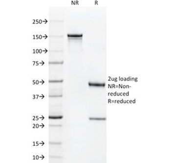 CD1a Antibody