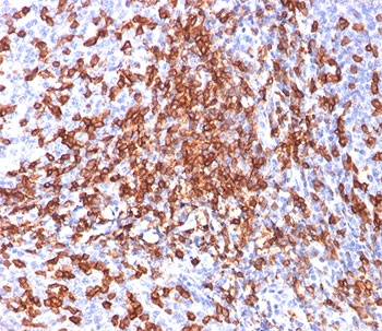 CD44 Antibody / HCAM