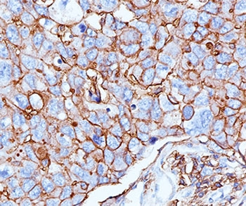 CD44 Antibody / HCAM