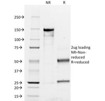 CD45RO Antibody (T-cell marker)