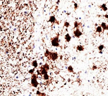 PGP9.5 Antibody / UchL1