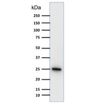 PGP9.5 Antibody / UchL1