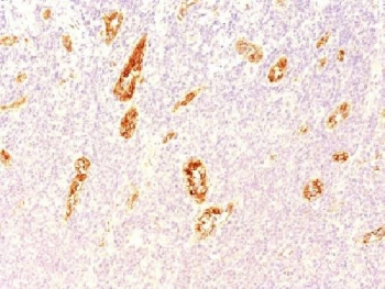 von Willebrand Factor Antibody / vWF