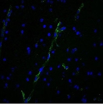 von Willebrand Factor Antibody / vWF