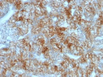 Cadherin 16 Antibody