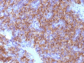 Chromogranin A Antibody