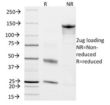 Chromogranin A Antibody