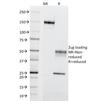 CCR5 Antibody
