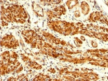 Calponin 1 Antibody