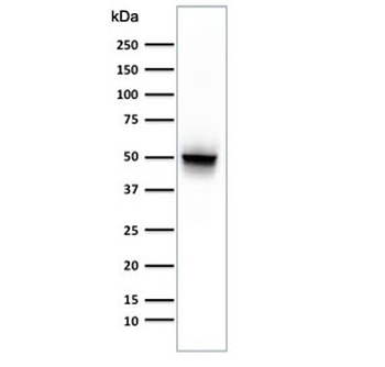 GFAP Antibody