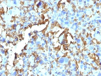 HLA-DRB1 Antibody (MHC II)