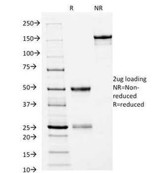 HLA-DRB1 Antibody (MHC II)