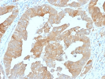 IDH1 Antibody