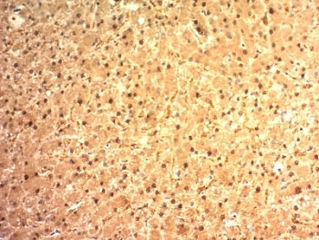 Arginase 1 Antibody