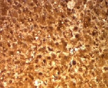 Arginase Antibody