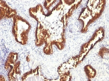 Keratin 18 Antibody