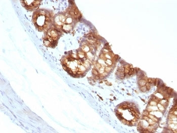 Keratin 18 Antibody