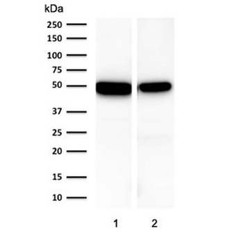 Keratin 18 Antibody
