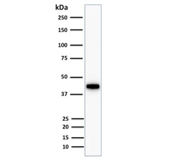 Keratin 18 Antibody