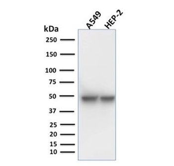 Keratin 18 Antibody
