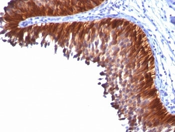 Cytokeratin 18 Antibody