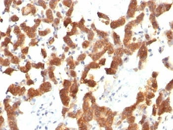 Cytokeratin 18 Antibody