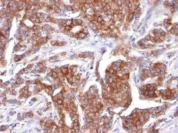Cytokeratin 18 Antibody