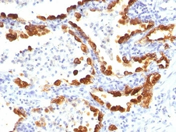 Cytokeratin 18 Antibody