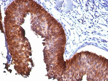 Cytokeratin 18 Antibody