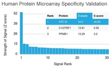 CK18 Antibody / Cytokeratin 18