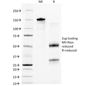 CK18 Antibody / Cytokeratin 18