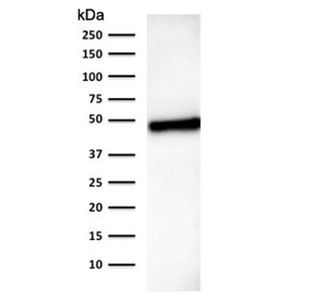 CK18 Antibody / Cytokeratin 18
