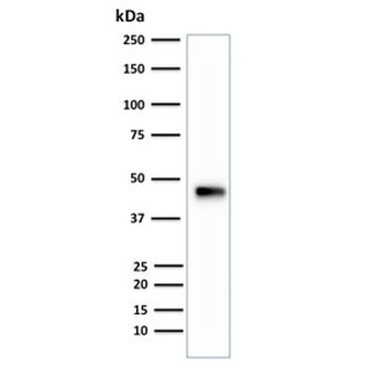 CK18 Antibody / Cytokeratin 18