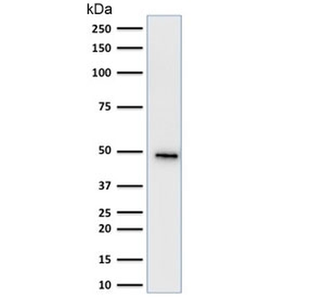 Cytokeratin 19 Antibody