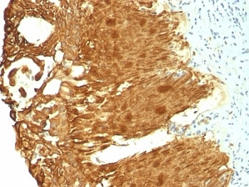 Cytokeratin 19 Antibody Cocktail
