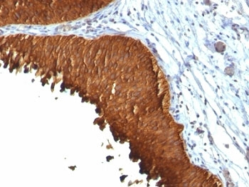 Cytokeratin 19 Antibody Cocktail