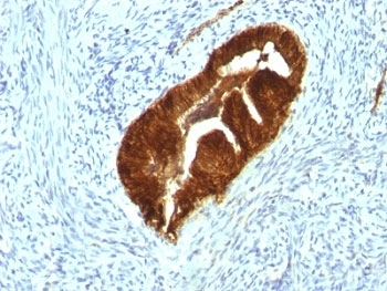 Cytokeratin 19 Antibody Cocktail