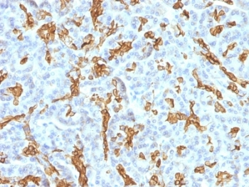 Cytokeratin 19 Antibody Cocktail
