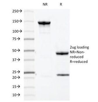 MUC1 Antibody / Mucin-1