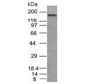 NCAM / CD56 Antibody
